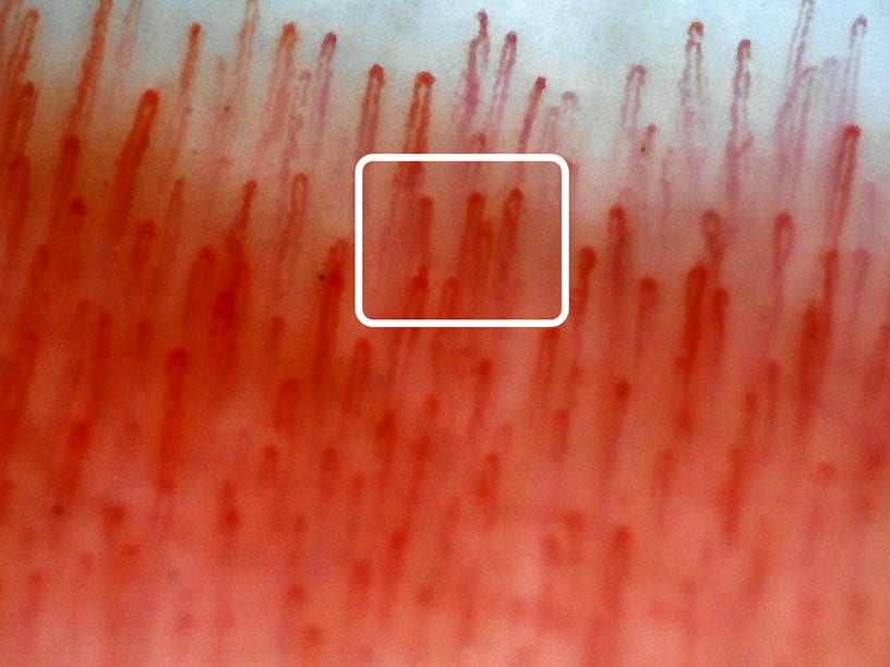 Nailfold capillaries (at lower magnification)200X, upgraded color reproducibility [New version (Ver.1.1)]
