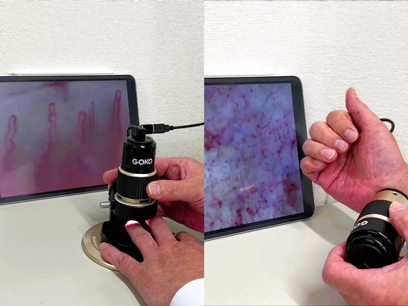 iPadでも毛細血管画像観察・保存できます