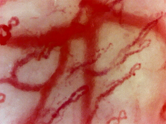 Lip capillaries (Massive zoom)