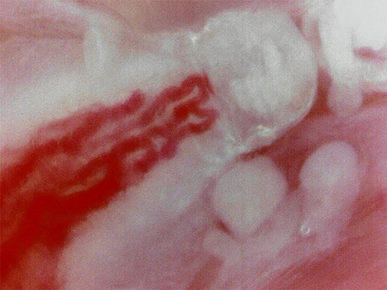 Tongue capillaries (Massive zoom)