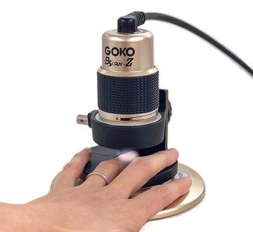 全身毛細血管スコープGOKO Bscan-Zを使用した指先爪郭部の毛細血管観察方法