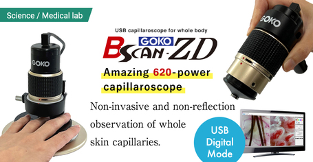 Capillaroscopy: USB Capillaroscope GOKO Bscan-ZD