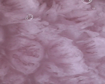 Capillaries in taste buds *