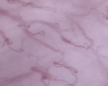 Capillaries in the lips