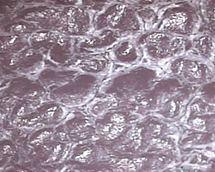 Extra skin of the heel (100×)