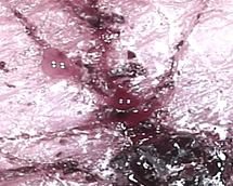 Wounds (100×)