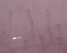 Straight, aligned, and hairpin-shaped capillaries