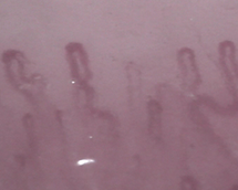 Twisted and uneven capillaries
