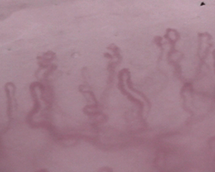 Branched capillaries