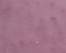 タShort and less-visible capillaries