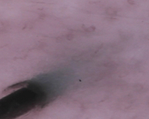 Capillaries near hair roots (i)*