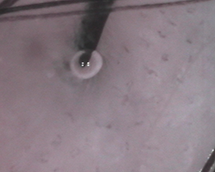 Capillaries near hair roots (ii)*