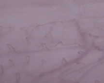 Gum capillaries *