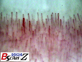 最終値下　毛細血管スコープ　品