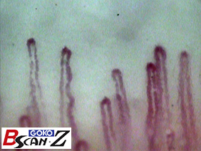 全身毛細血管スコープGOKO Bscan-Zで撮影した約590倍の指先爪郭部の毛細血管画像