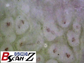 全身毛細血管スコープGOKO Bscan-Zで撮影した約560倍の前腕の毛細血管画像
