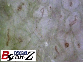 全身毛細血管スコープGOKO Bscan-Zで撮影した約560倍の前腕の毛細血管画像