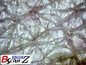 Skin surface which is magnified up to 150 times which was taken by the capillaroscope GOKO Bscan-Z