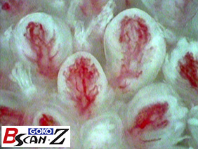 全身毛細血管スコープGOKO Bscan-Zで撮影した約150倍の舌乳頭の毛細血管画像