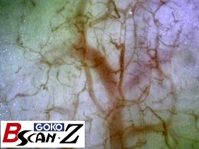 全身毛細血管スコープGOKO Bscan-Zで撮影した約150倍の口腔粘膜の毛細血管画像