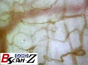 全身毛細血管スコープGOKO Bscan-Zで撮影した約560倍の口唇の毛細血管画像