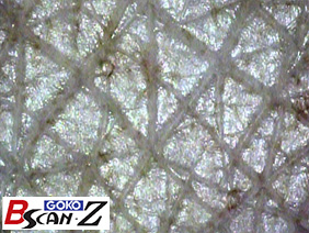 Skin texture which are magnified up to 150 times which was taken by the capillaroscope GOKO Bscan-Z