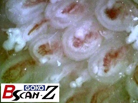 全身毛細血管スコープGOKO Bscan-Zで撮影した約150倍の舌乳頭の毛細血管画像