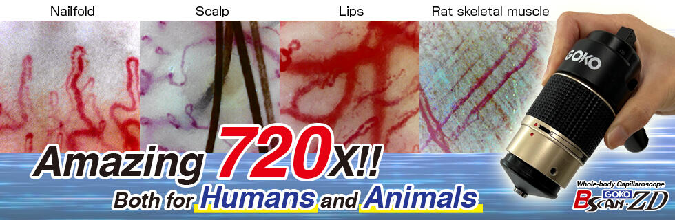 Bscan-ZD／Amazing 620X!! Both for Humans and Animals