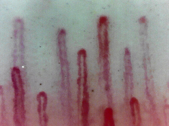 手指の爪郭部の毛細血管を620倍で撮影