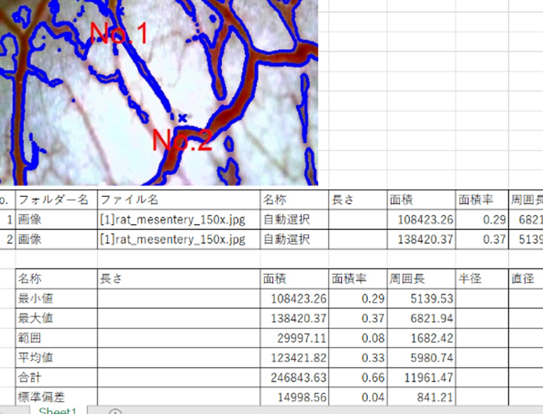 Excel転送のスクリーンショット