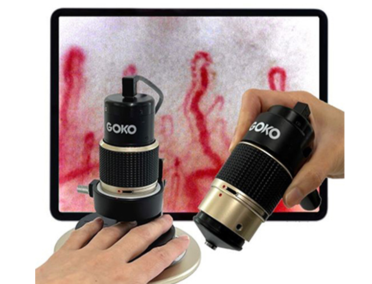 全身毛細血管スコープGOKO Bscan-ZD製品とタブレットに映出した毛細血管
