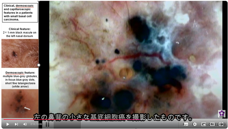 齋藤先生の研究成果をぜひ動画でご覧ください