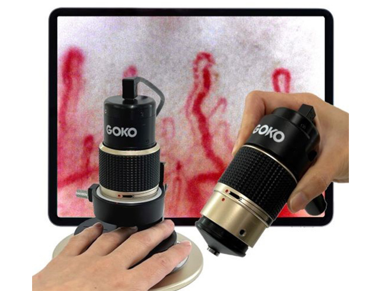 GOKO Bscan-ZDの写真