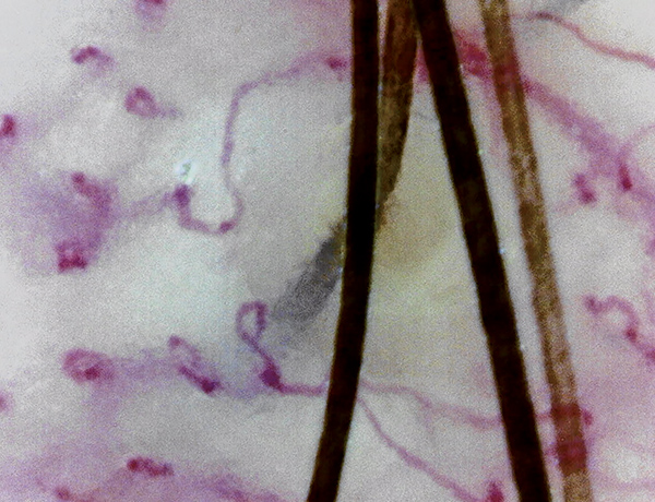 blood flow