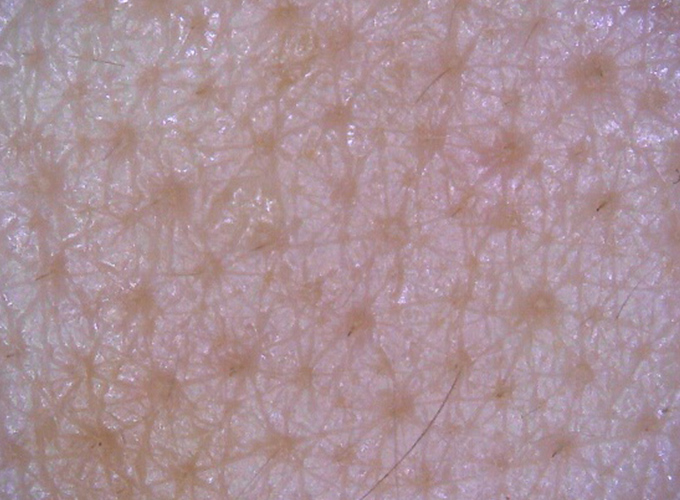Facial cheek texture (Approx. 50 times)