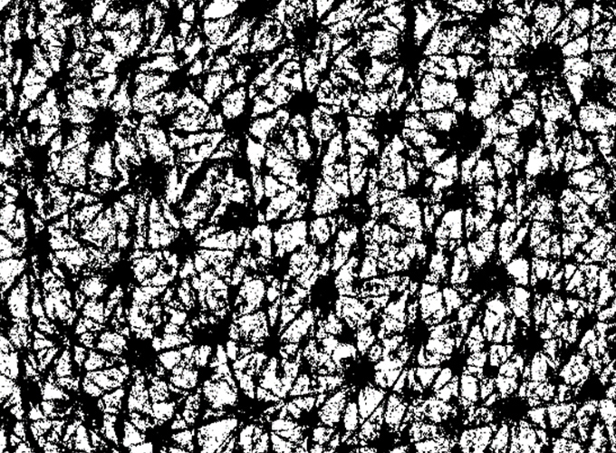 Image processing to separate the skin groove from the skin hill