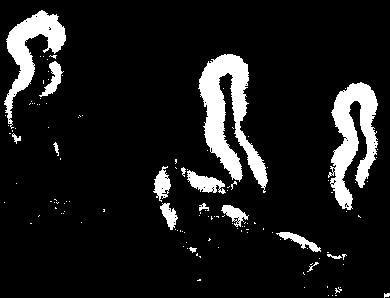 灌流領域マップ：施術前