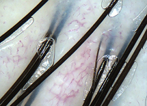 Scalp - Hair roots and capillaries