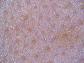 Skin surface (Medium magnification)