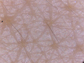 Skin surface (Higher magnification)
