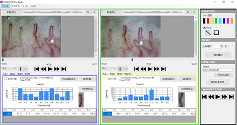 GOKO-VIP software for the measurement of the velocity of the capillaries