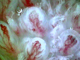 全身毛細血管血流スコープGOKO Bscan-Zで撮影した約150倍の舌の毛細血管（改良前）