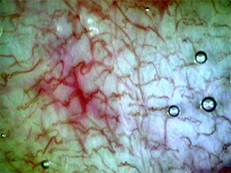 全身毛細血管血流スコープGOKO Bscan-Zで撮影した約560倍の口唇の毛細血管（改良前）