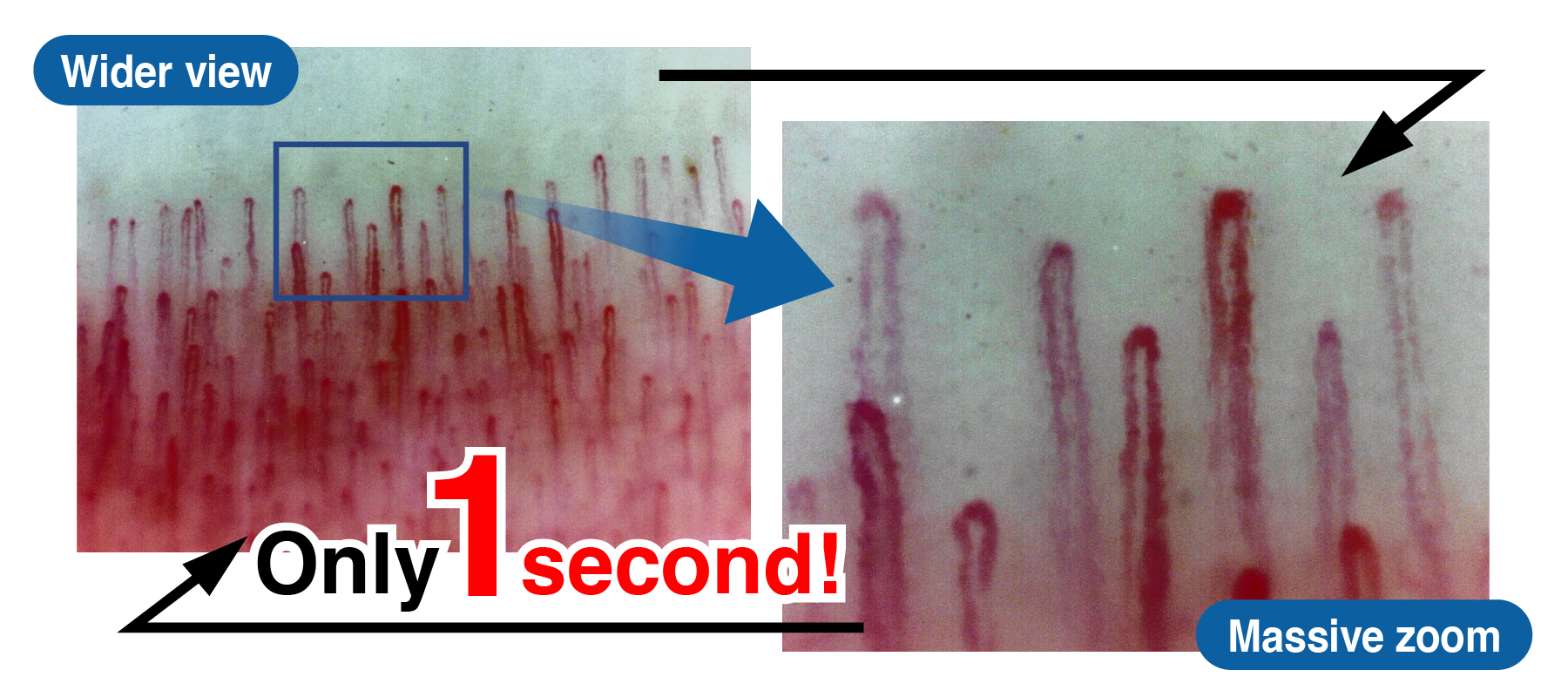 Capillary scope - you can switch between 'whole image' and 'super magnification' in only one second.
