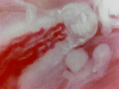 舌の毛細血管（高倍率側）