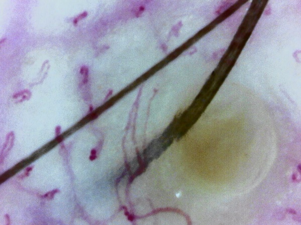 Scalp capillaries (Massive zoom)