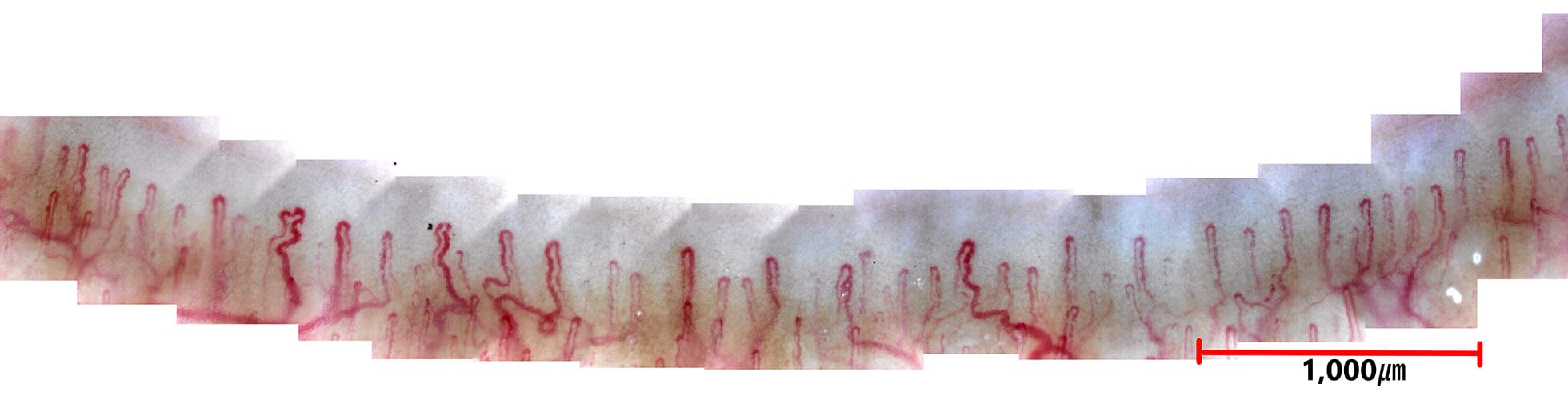 指先毛細血管のパノラマ画像（620倍で撮影）