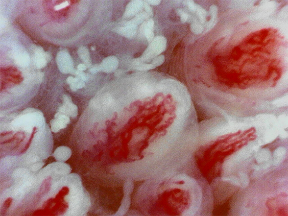 舌 毛細血管・血流（全体像）