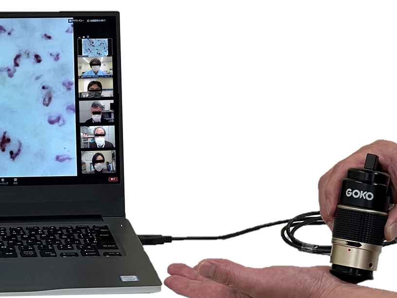 Real-time blood flow images shared remotely via Zoom application