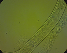 Bright-field image and fluorescence observation by fluorescence microscope